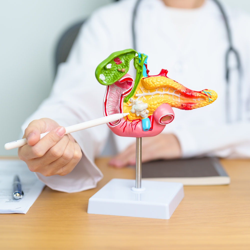 Cáncer del Aparato Digestivo